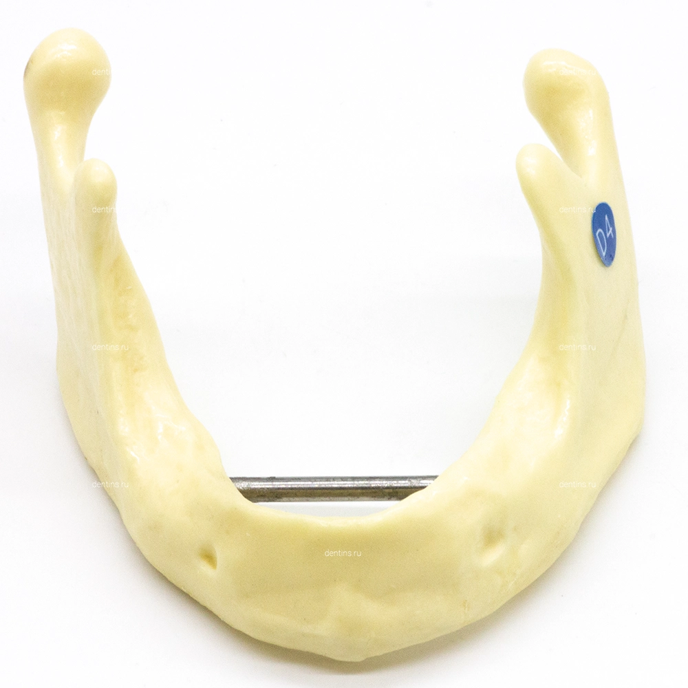 Учебная модель для имплантации и расщепления костного гребня, нижняя челюсть
