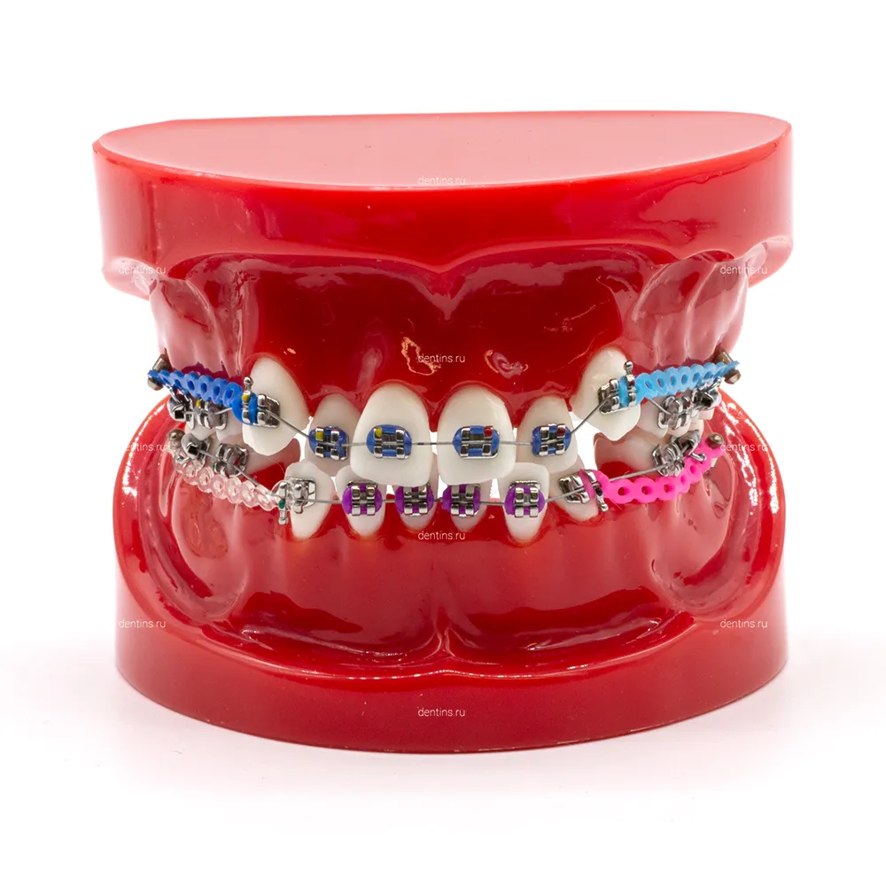Демонстрационная ортодонтическая модель челюсти, патологическая, красная