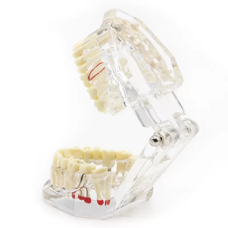 Демонстрационная модель челюсти с зубами прозрачная, патологическая