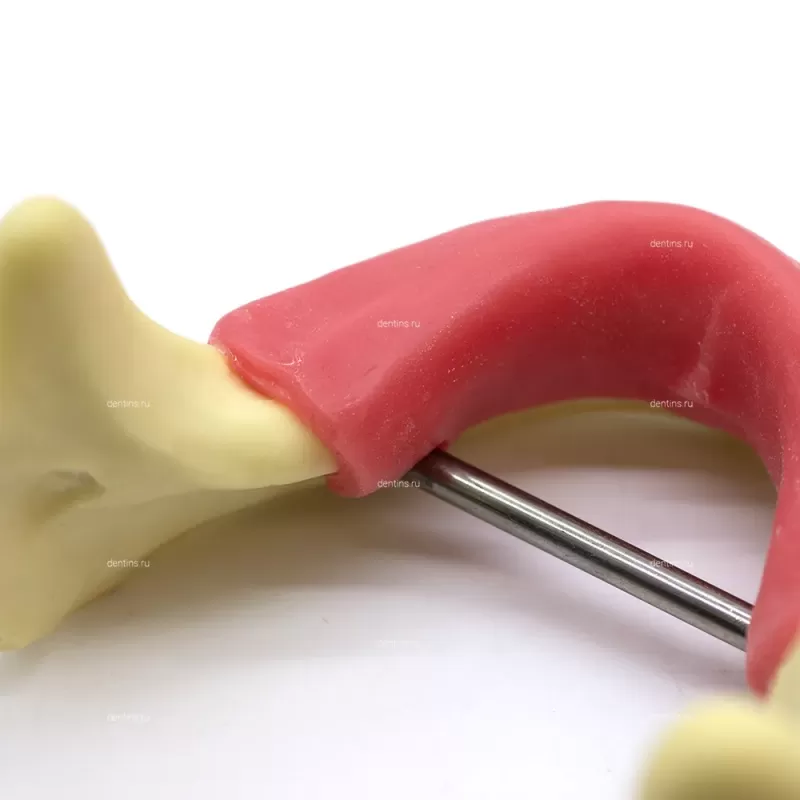 Учебная модель для имплантации, расщепления костного гребня, нижняя челюсть