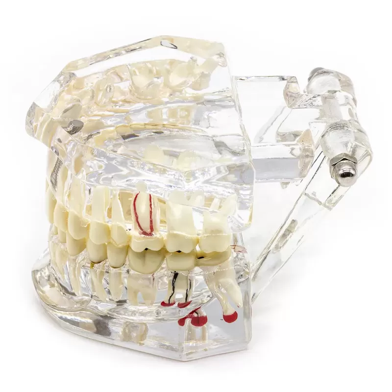 Демонстрационная модель челюсти с зубами прозрачная, патологическая