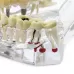 Демонстрационная модель челюсти с зубами прозрачная, патологическая фото