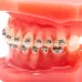 Демонстрационная ортодонтическая модель челюсти с металлическими брекетами