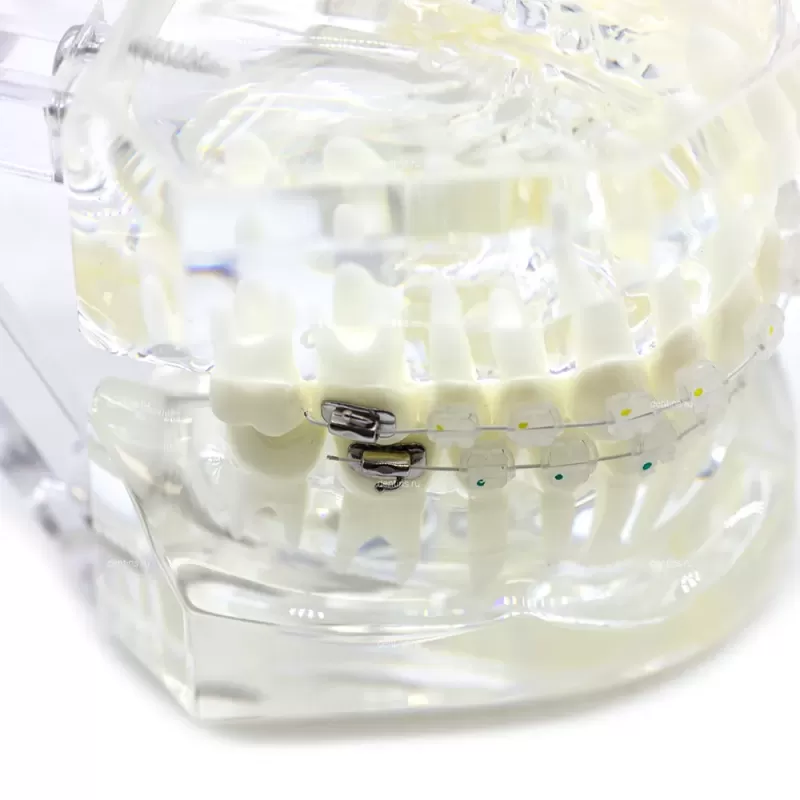 Демонстрационная ортодонтическая модель челюсти с керамическими брекетами, прозрачная